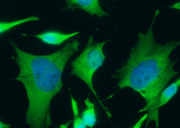 Anti-FDPS/Farnesyl Diphosphate Synthase Monoclonal Recombinant Antibody