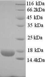Ropporin-1B (ROPN1B), human, recombinant
