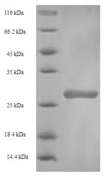 Beta-1,4-galactosyltransferase 1 (B4GALT1), partial, bovine, recombinant