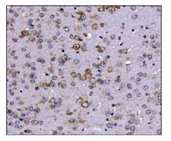 Anti-SCN1B