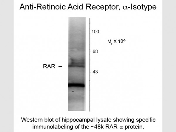 Anti-Retinoic Acid Receptor alpha, clone 763