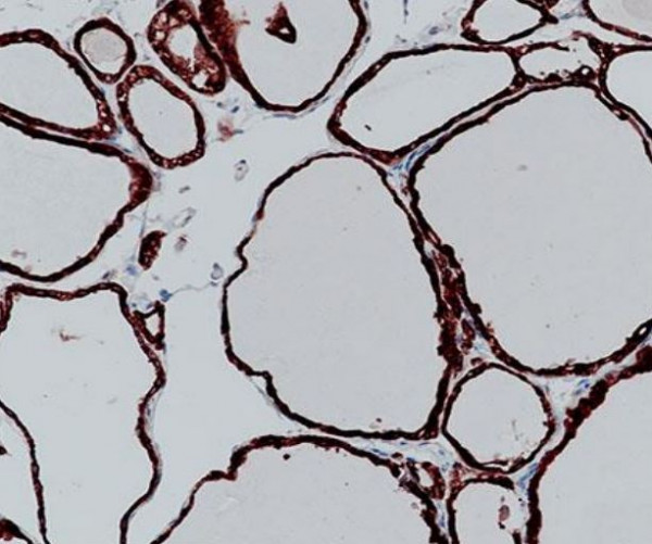 Anti-Tpo / Thrombopoietin, clone SQab19153