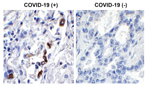 Anti-SARS-CoV-2 ORF3a