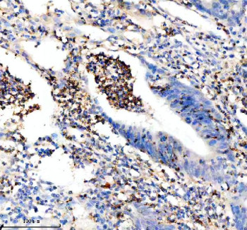Anti-GZMM / Granzyme M