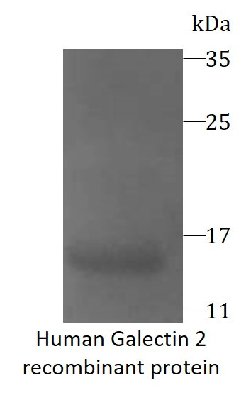 Human Galectin 2 recombinant protein (Active) (His-tagged)