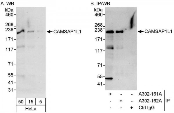 Anti-CAMSAP1L1