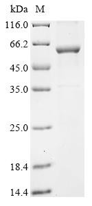 Cytochrome P450 2A13 (CYP2A13), human, recombinant