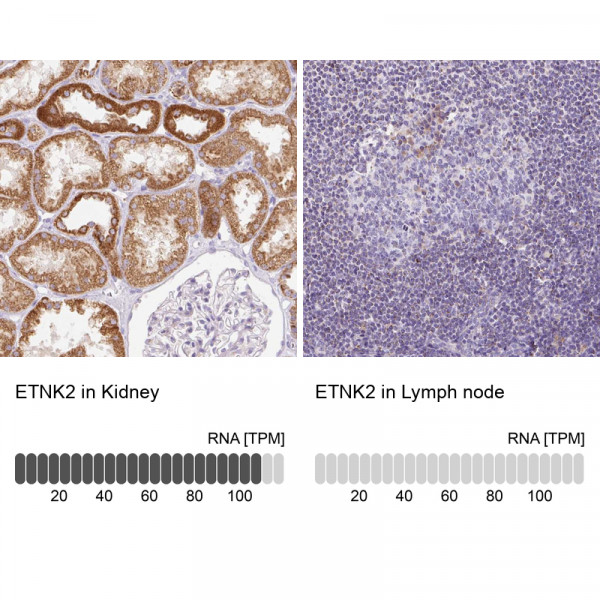 Anti-ETNK2