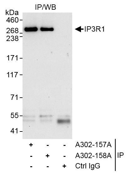 Anti-IP3R1