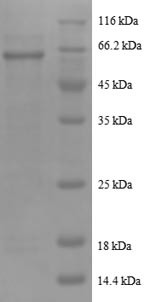 Serine/threonine-protein phosphatase 2A catalytic subunit beta isoform (PPP2CB), human, recombinant