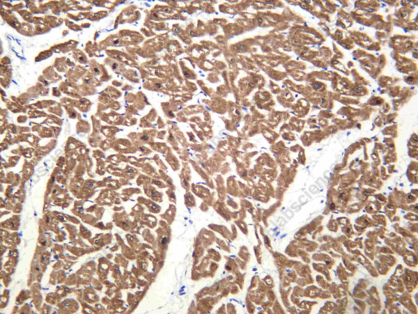 Anti-Recombinant PLB, clone C112477