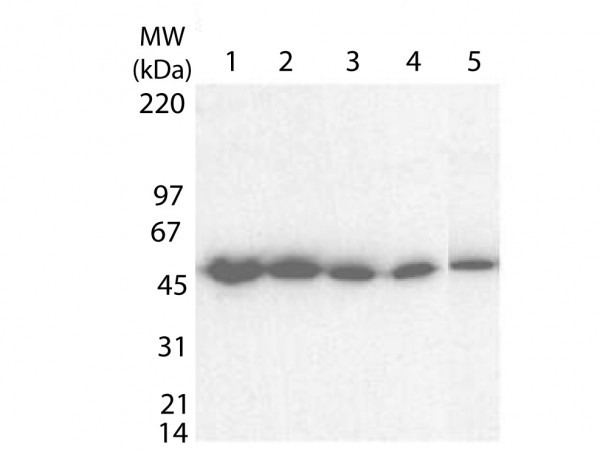Anti-Tetanus Toxin, fragment C (TTFC)