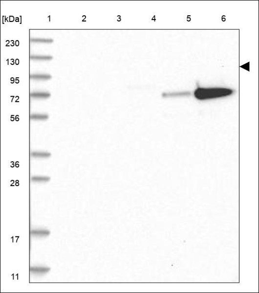 Anti-INPP5B
