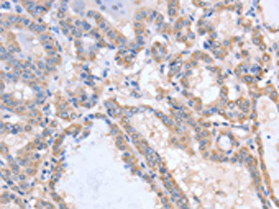 Anti-ACVR1C