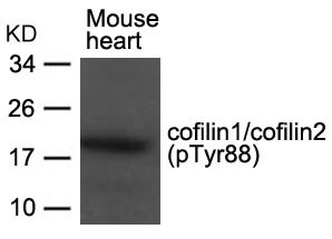 Anti-phospho-cofilin1/cofilin2 (Tyr88)