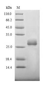 Spike glycoprotein (S), partial, Bovine coronavirus, recombinant