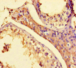 Anti-SETD1A