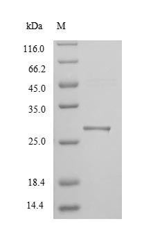 Hepatitis A virus cellular receptor 1 homolog (Havcr1), partial, mouse, recombinant