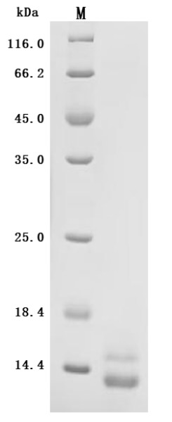 Inositol 1,4,5-trisphosphate receptor-interacting protein-like 1 (ITPRIPL1), partial (Active), recom