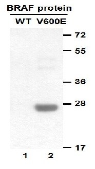 Anti-B-Raf (V600E), monoclonal