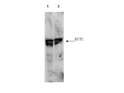 Anti-phospho-ECT2 (Thr790) (Epithelial Cell Transforming Sequence 2)