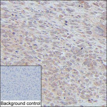 Anti-Myoblast Determination Protein 1