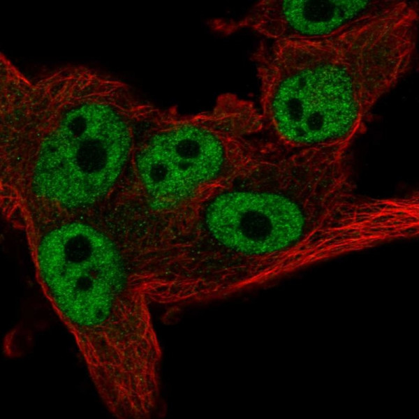 Anti-CNOT11