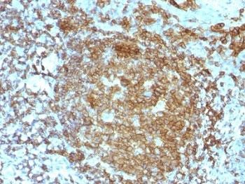 Anti-CD45RA (Leukocyte marker), clone PTPRC/818