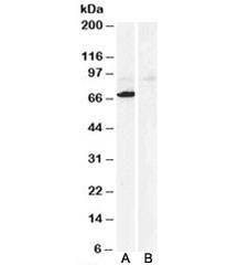 Anti-Monoamine Oxidase A