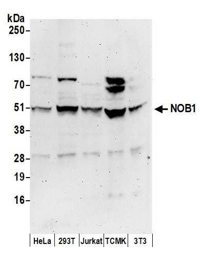 Anti-NOB1