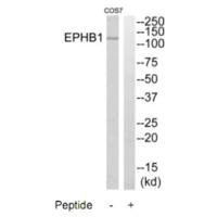 Anti-EPHB1