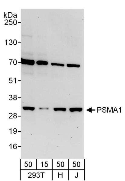 Anti-PSMA1