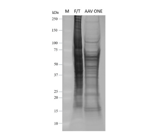 AAV ONE-Extract(TM) Solution
