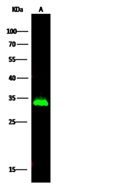 Anti-HNMT Monoclonal Recombinant Antibody