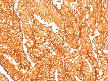 Anti-EpCAM (recombinant antibody), clone EGP40/1556R