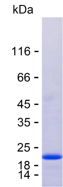 Recombinant Human IDH1 Protein