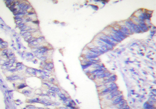 Anti-BCL2