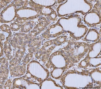 Anti-ANXA10 / Annexin A10