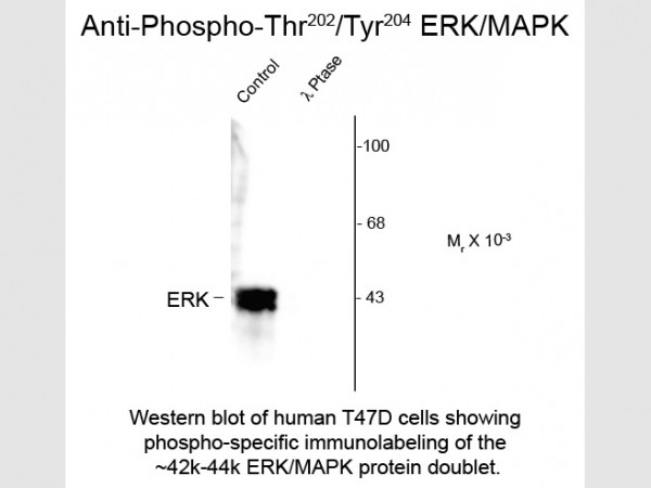 Anti-phospho-ERK/MAPK (Thr202/Tyr204)