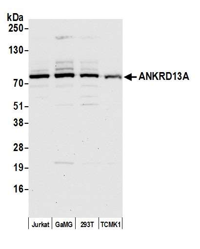 Anti-ANKRD13A