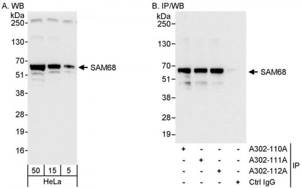 Anti-SAM68