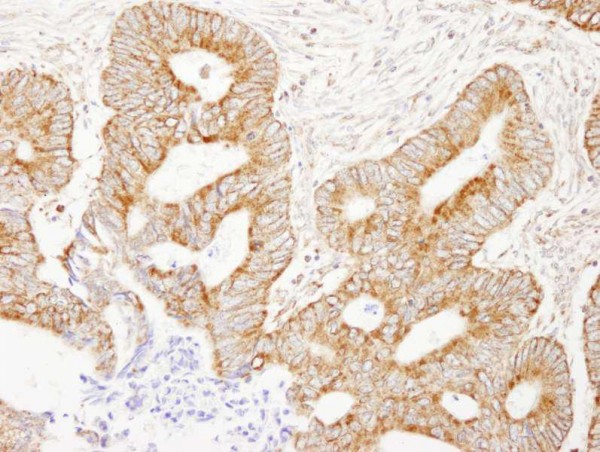 Anti-AKAP1 (IHC)