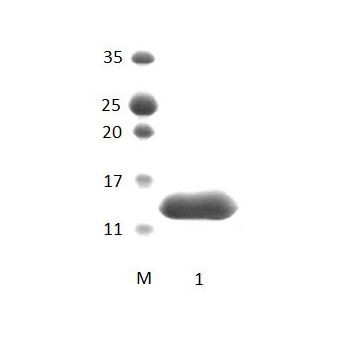 MAST1 PDZ Domain