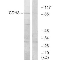 Anti-CDH8