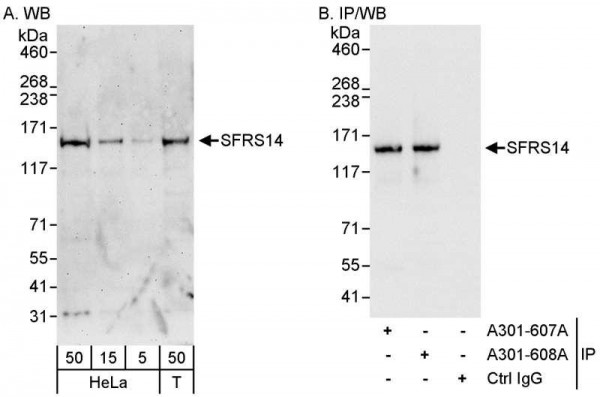 Anti-SFRS14