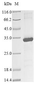 Killer cell immunoglobulin-like receptor 2DS3 (KIR2DS3), partial, human, recombinant