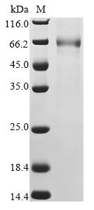 Spike glycoprotein (S), partial, human betacoronavirus 2c EMC/2012, recombinant