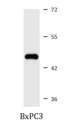 Anti-GDNF Receptor alpha 3