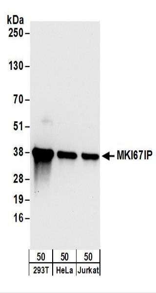 Anti-MKI67IP