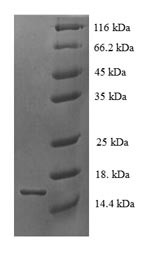Tetraspanin-7 (TSPAN7), partial, human, recombinant